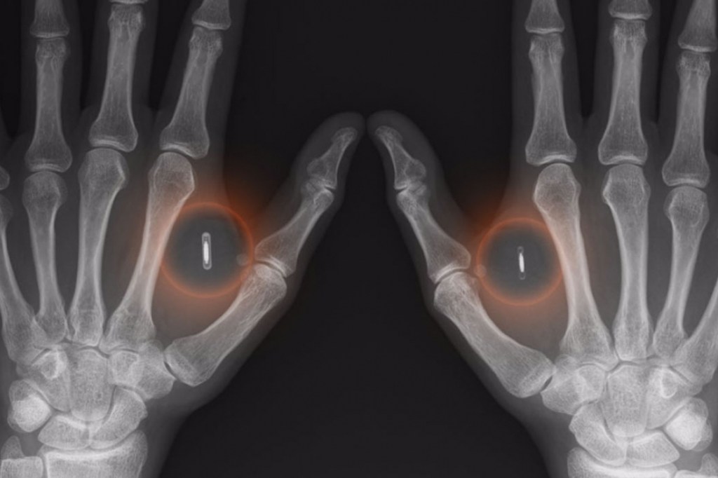 „Dass Technologie die Haut durchbricht, ist ein&nbsp;No-Brainer“